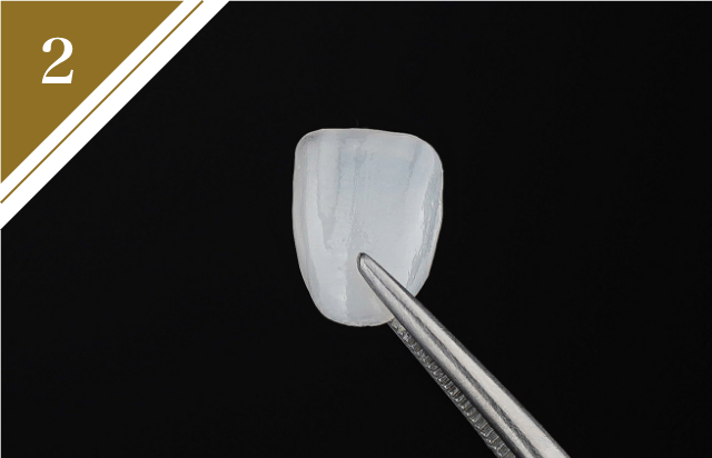 セラミック治療